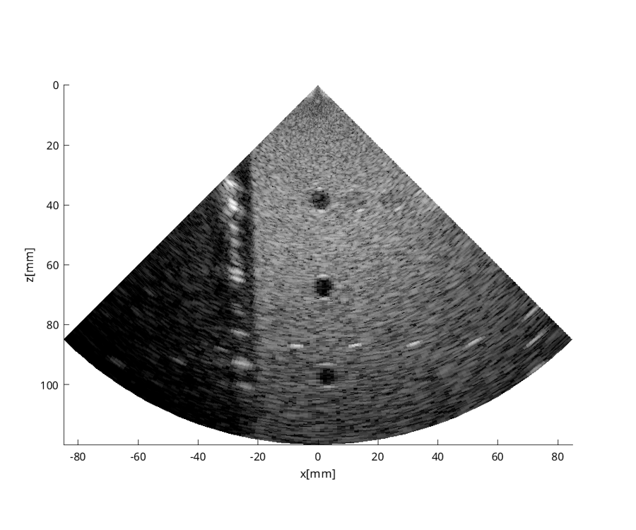 Preview for FI_P4_cysts_center.uff