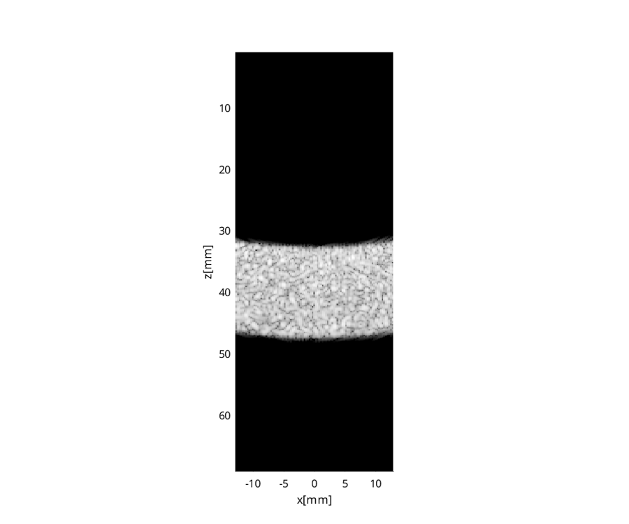Preview for FieldII_speckle_DMASsimulation300000pts.uff
