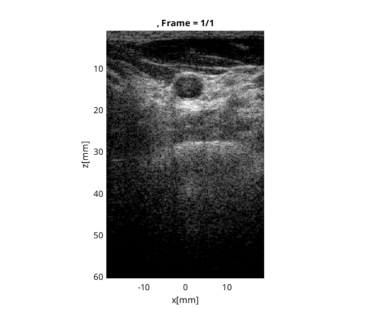 Preview for L7_FI_carotid_cross_1.uff
