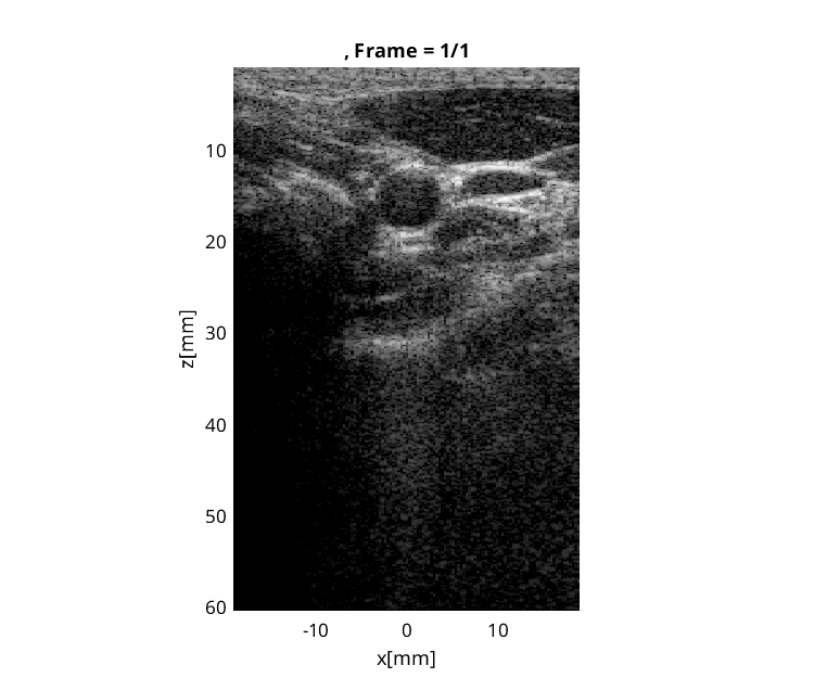 Preview for L7_FI_carotid_cross_2.uff
