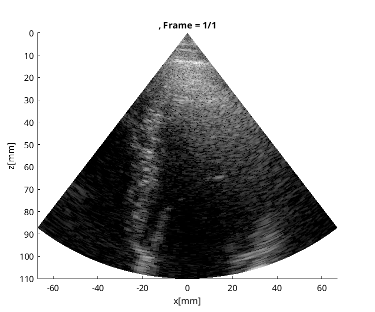 Preview for Verasonics_P2-4_apical_four_chamber_subject_1.uff